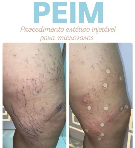 Estética domicílio