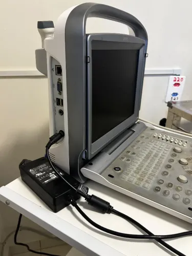 Ultrassom Chison eco 06