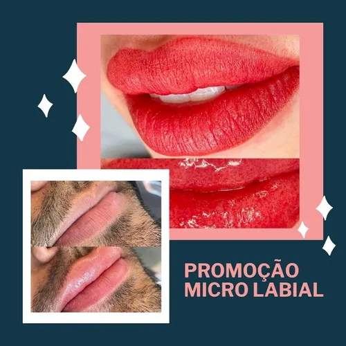 Renove sua Autoestima PROMO MICRO LABIAL