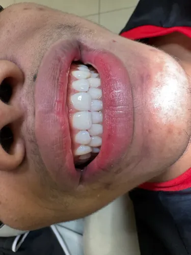 DENTISTA BELÉM E ICOARACI
