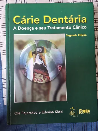 Livro Odontologia Cárie Dentária Fejerskov