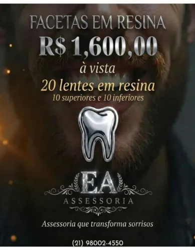 Sorriso Novo: 20 Facetas em Resina (10 Superiores + 10 Inferiores) em OFERTA