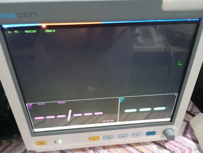 Monitor multi parâmetros adcom