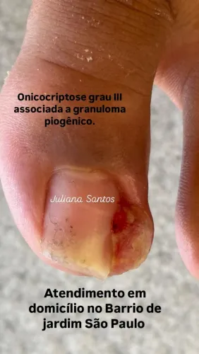 Podologia humanizada