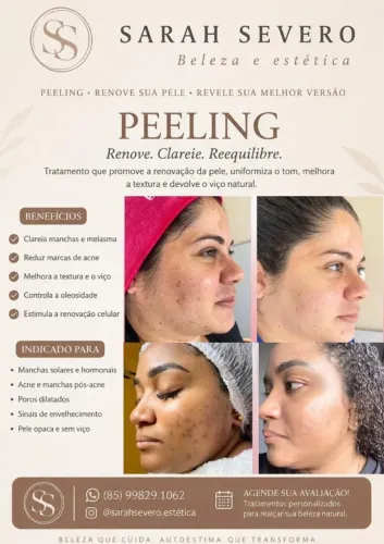 ESTETICISTA (CLAREAMENTO FACIAL/CORPORAL)