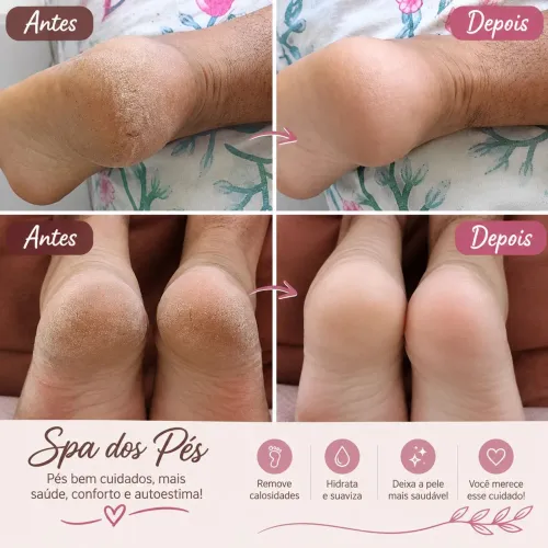 SPA dos pés 