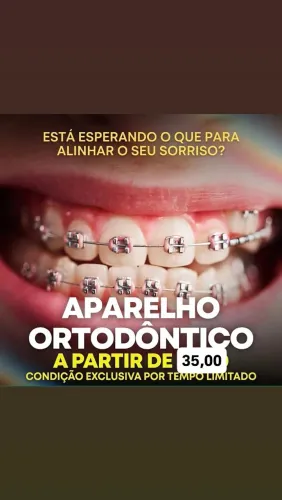 Aparelho ortodôntico manutenção