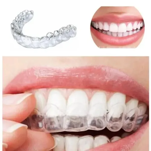 1 Par Placa moldavel pra clareamento dentes antibruxismo