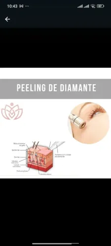Peeling de diamante 