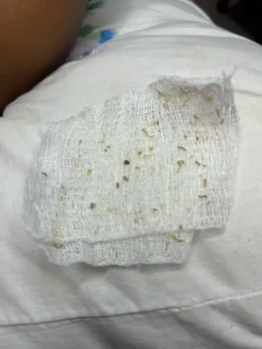 Limpeza de pele a domicílio