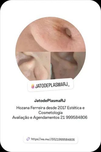 Jato de Plasma