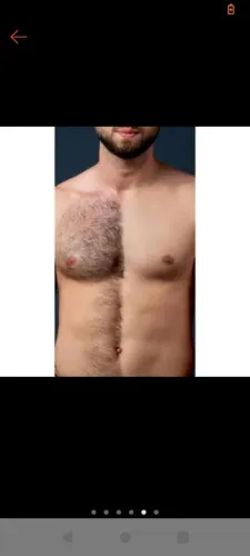 DEPILAÇÃO MASCULINA ÍNTIMA E INDOLOR