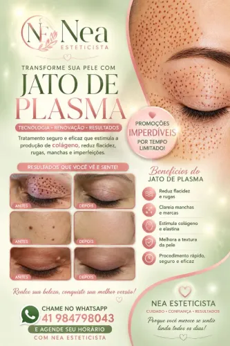 Jato de plasma