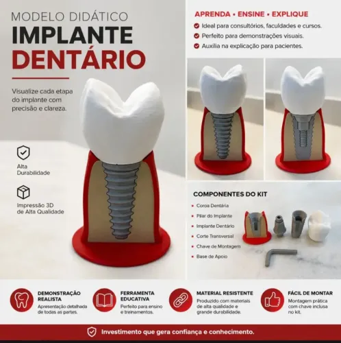 Macro modelo didático de implante dentário