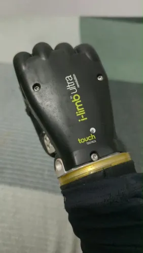 Mão biônica i-limb Ultra Revolution