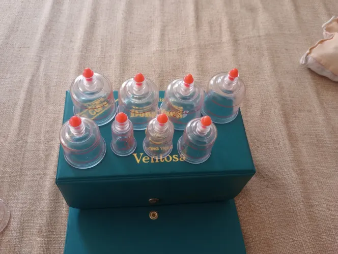 Vendo 8 copos de ventosa 100 reais