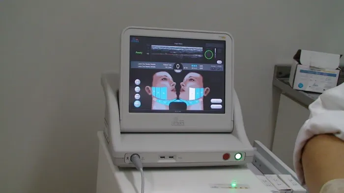 Aparelho de Estética Ulthera Hifu de Ultrassom MICROFOCADO E MACROFOCADO 