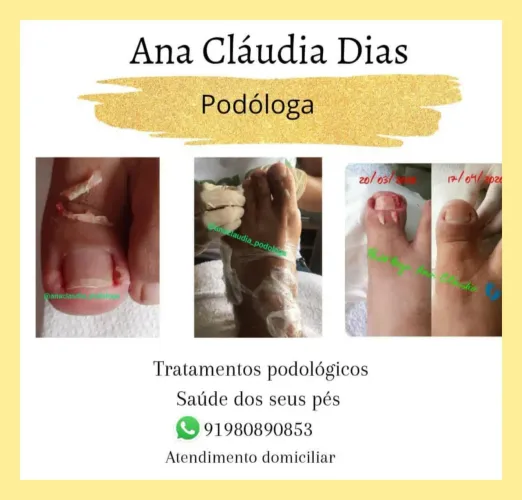 Podóloga em domicílio 