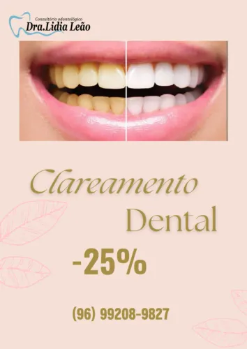Clareamento Dental Semana das Mães não fique de fora!