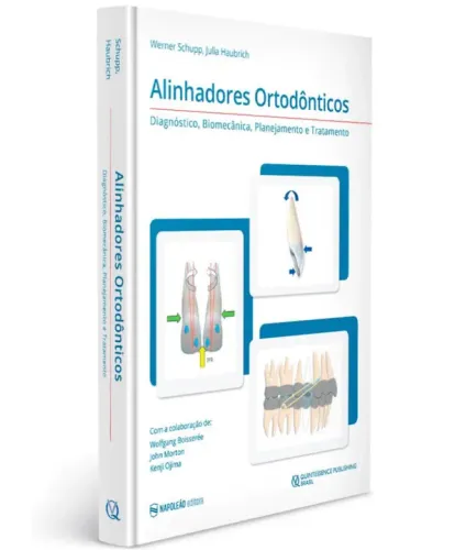 Livro Alinhadores Ortodônticos
