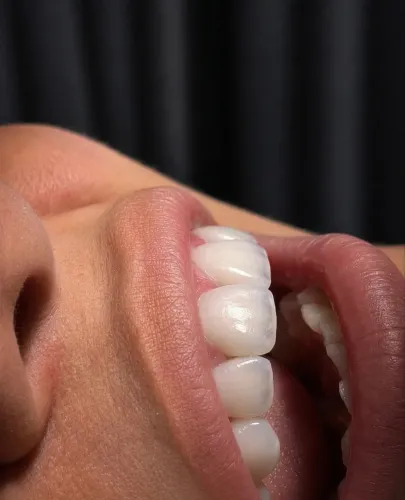 Vaga para Cirurgião Dentista