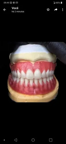 Próteses Dentária