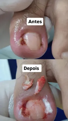 Podóloga/ Podologia 