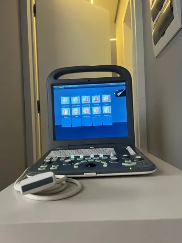 Ultrassom portátil, estado de novo, pouco uso,(ano18/19.)