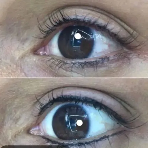 Micropiguimentaç?o chandw compcta fio esfumaçada etc Zap *