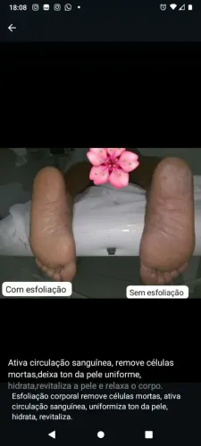 Depilação e procedimentos corporais 