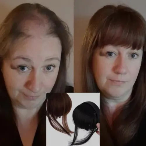 Franjas tiara para calvíce feminina 