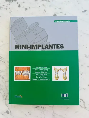 Livro Mini-Implantes (Sung, Kyung, Park, Mcnara e outros)
