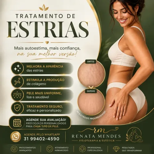 Tratamento de estrias 