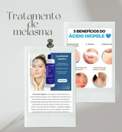 Clareador Facial Higpele - Melasma, Manchas e Espinhas