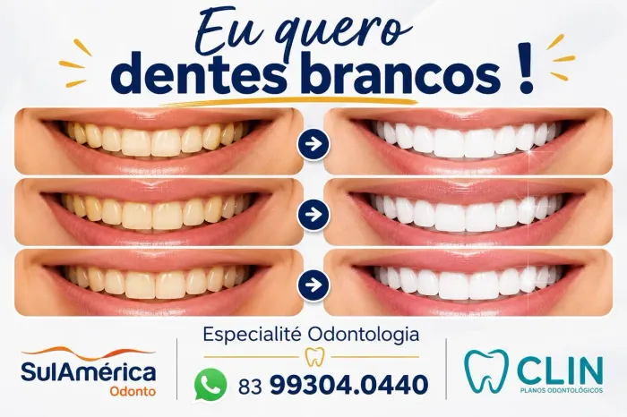 EU QUERO DENTES BRANCOS! Clareamento Dental em João Pessoa 