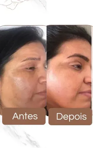 Kit cuidados com a pele Mary Kay