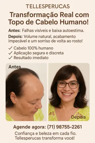 Transformação Capilar com Topo de Cabelo Humano