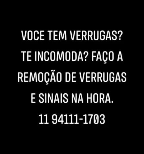 Remoção de verruga na hora