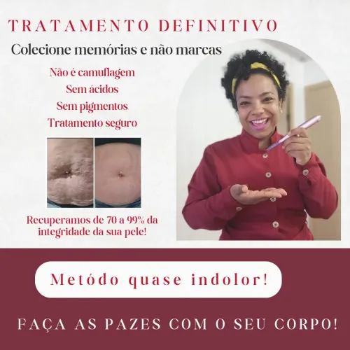 Tratamento DEFINITIVO de estrias e cicatrizes
