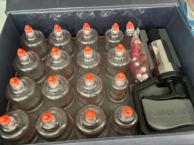 Vendo kit de Ventosas pouco usada . Estado de novo.