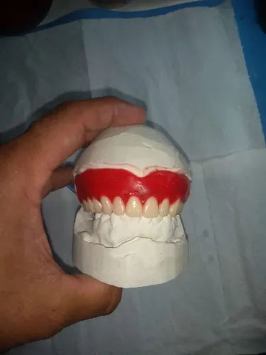 Prótese dentaria 