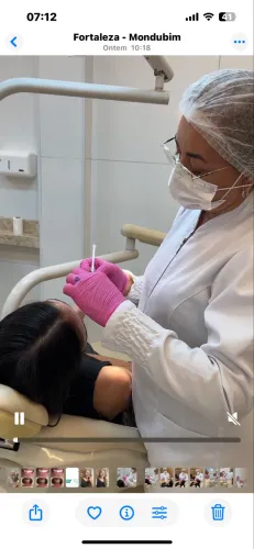 Botox facial