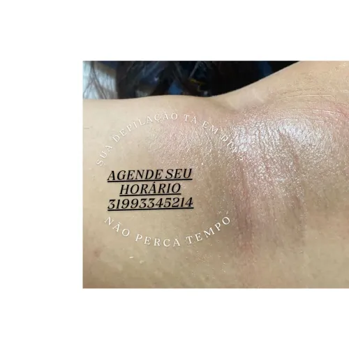 Depilaçao , SPA ,  escalda pés, Remoção de estrias 