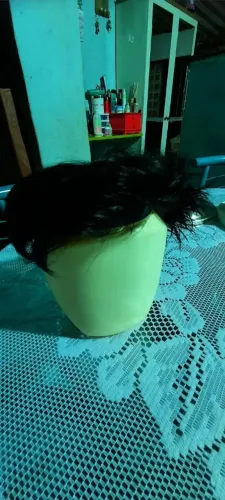 Prótese capilar 
