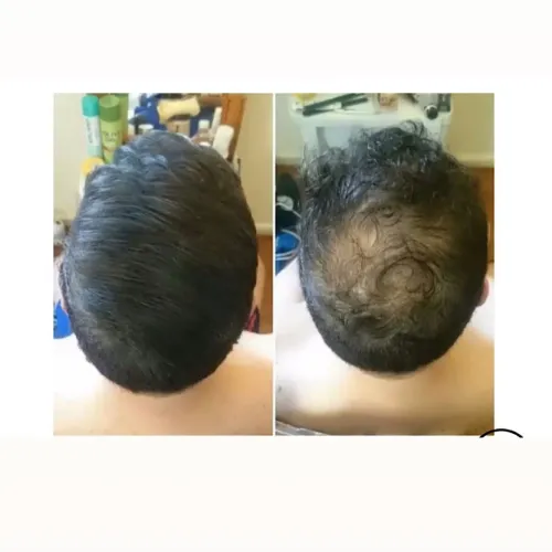 Maquiagem Capilar - Pó para cabelo - Fibra Capilar