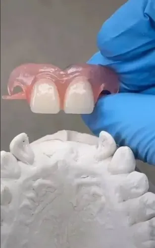 Prótese dentária 