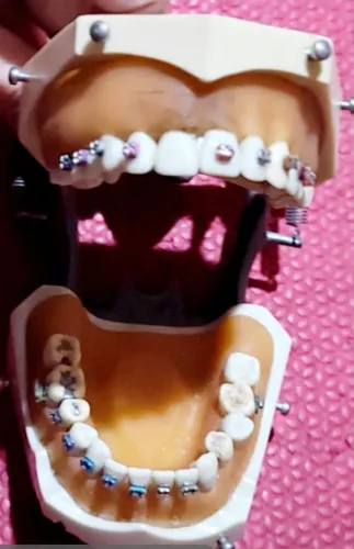 Modelo em silicone odontologico