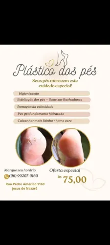 Plástica dos pés 