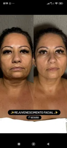 ?Manicure, Pedicure e Limpeza de Pele - Estética Natural