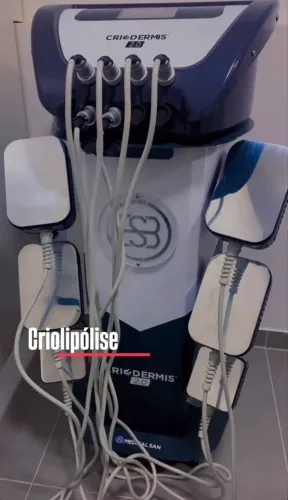 ALUGO DIÁRIA - máquina de Criolipólise